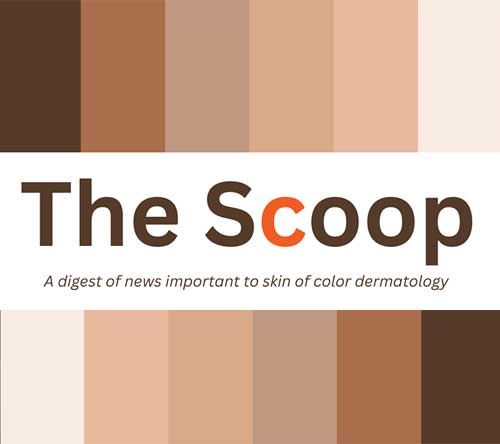 the scoop